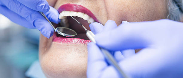Best Emergency Dental Filling Replacement  in Winner, SD